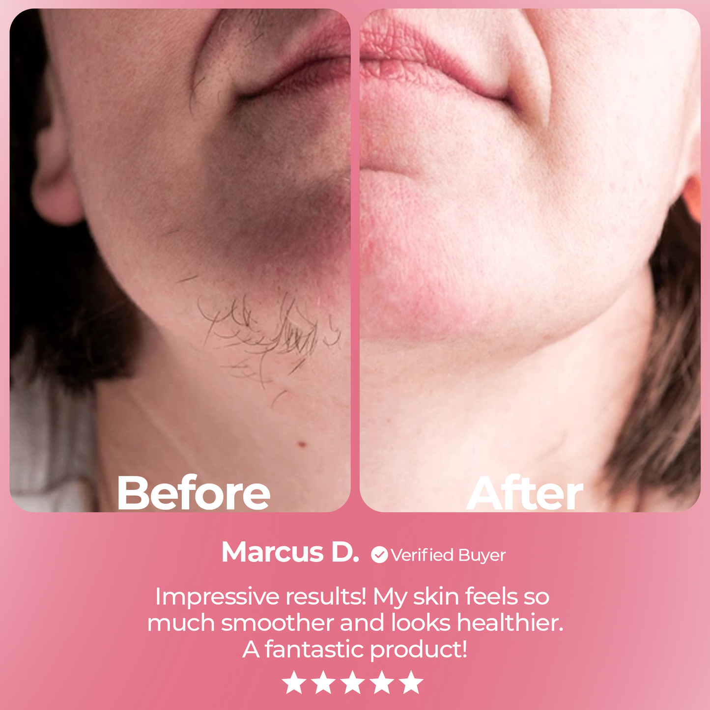 Luumra Instant Hair Removal Kit