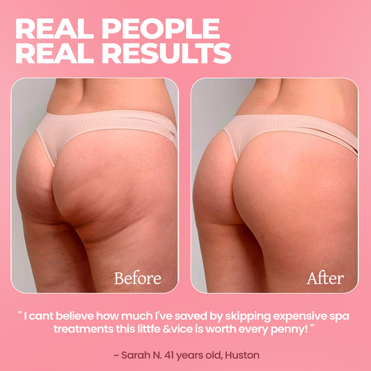 MiaGlow Cellulite Massager